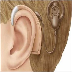 تحقیق درباره سمعک به افراد کم شنوا چه کمکی می کند
